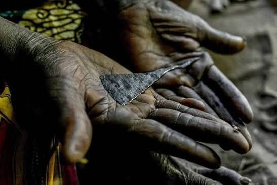 Horror in Kandara: Young Woman Allegedly Mutilated in Forced FGM Practice