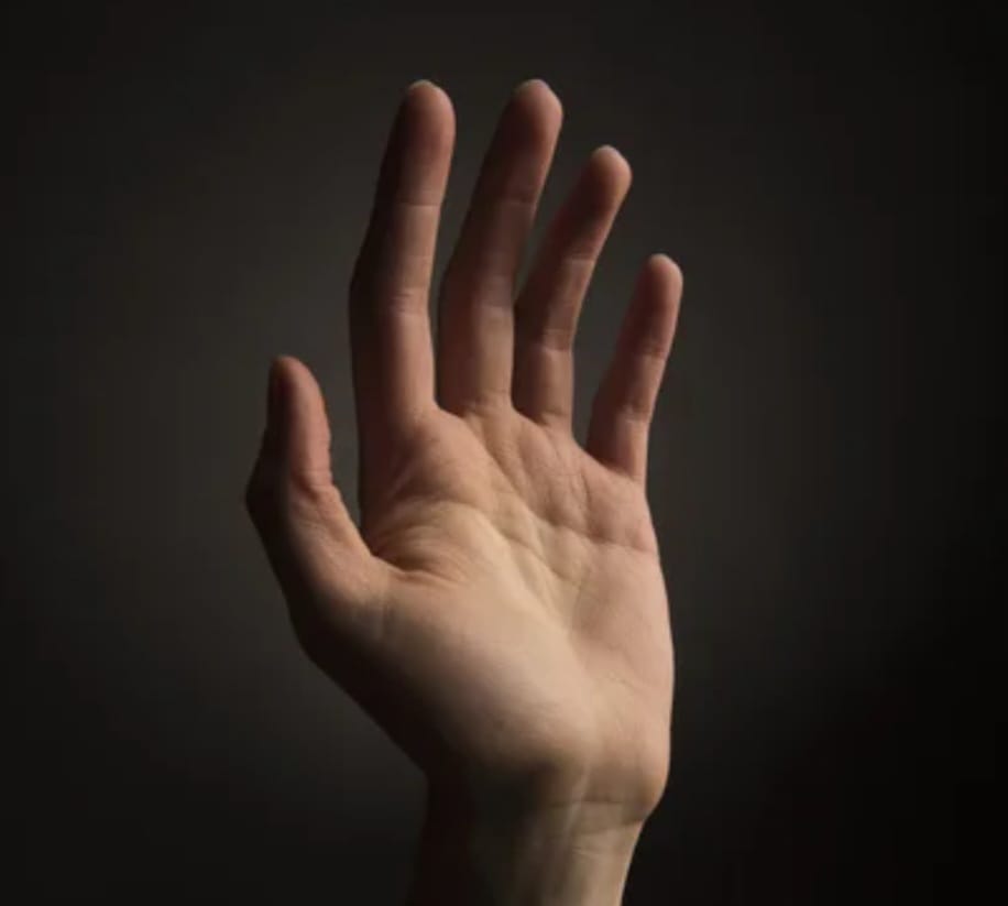 Woman loses hand after rejecting sexual demand