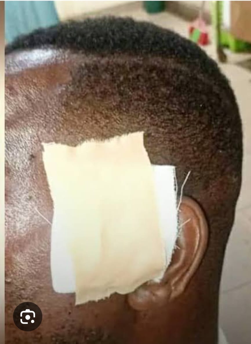 Drama in Likoni as Suspect Bites Ear of Police Officer