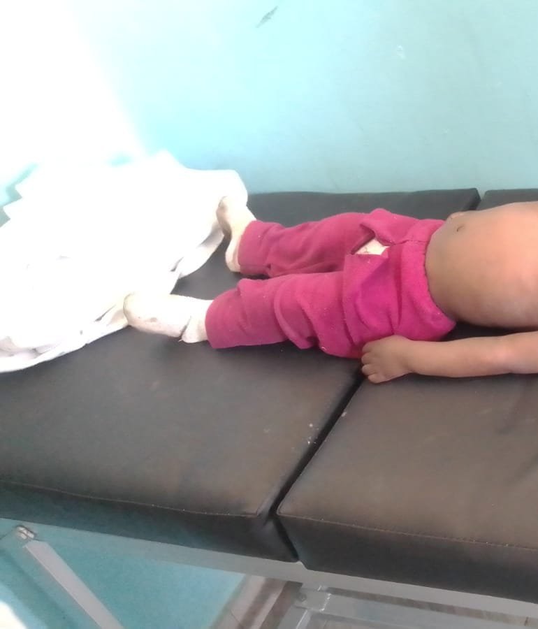 Toddler Drowns in Bucket Accident in Timau